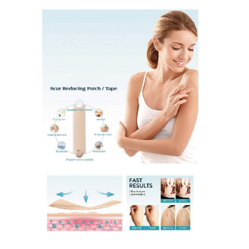 Siliconen dressing